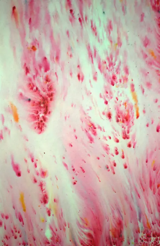 ��ɫī�ձ���-������