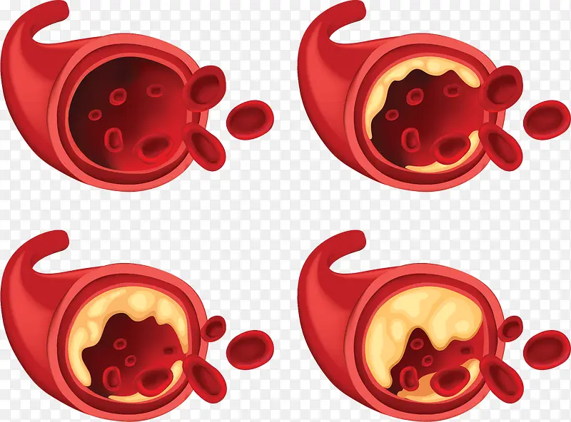 �����ѧѪ��˨��-������