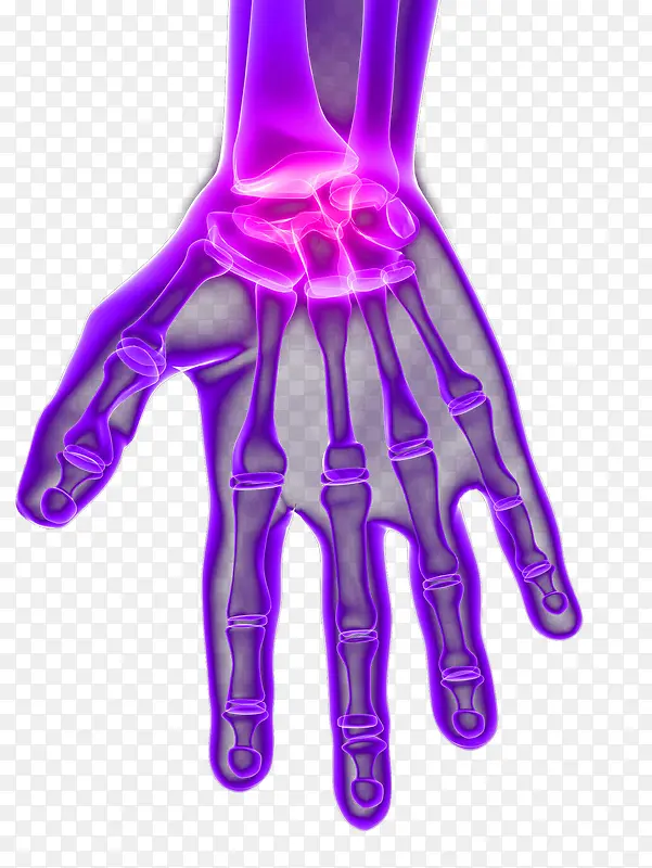 ��ָ�ؽ�-������