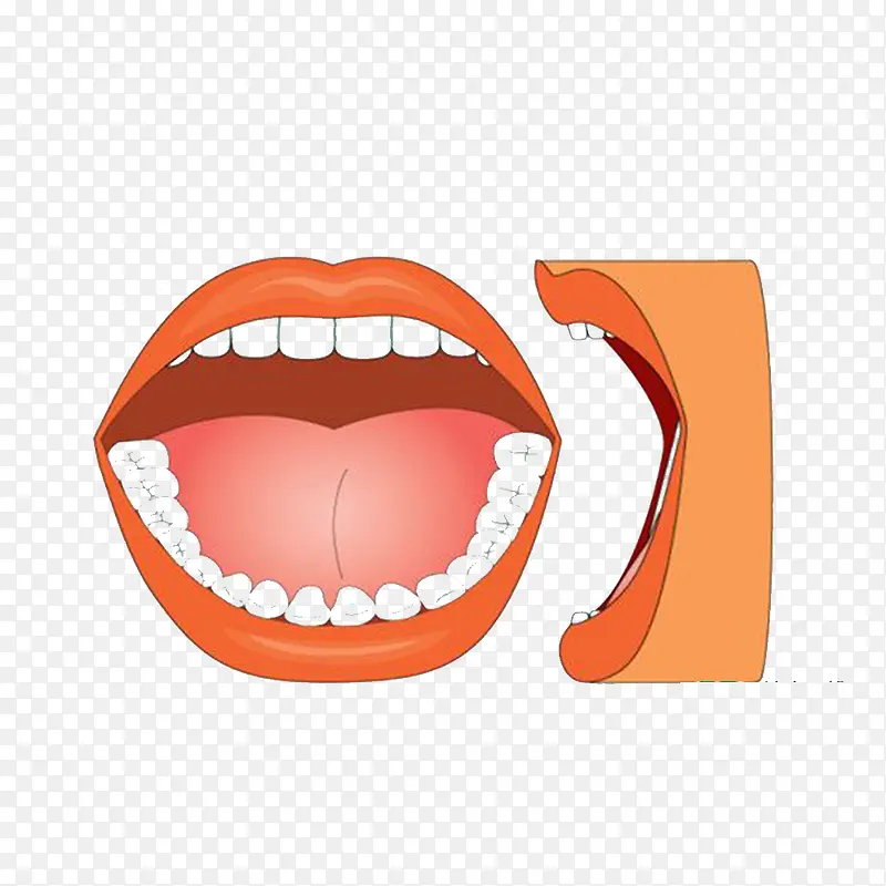 Ԥ����ǻ��-������