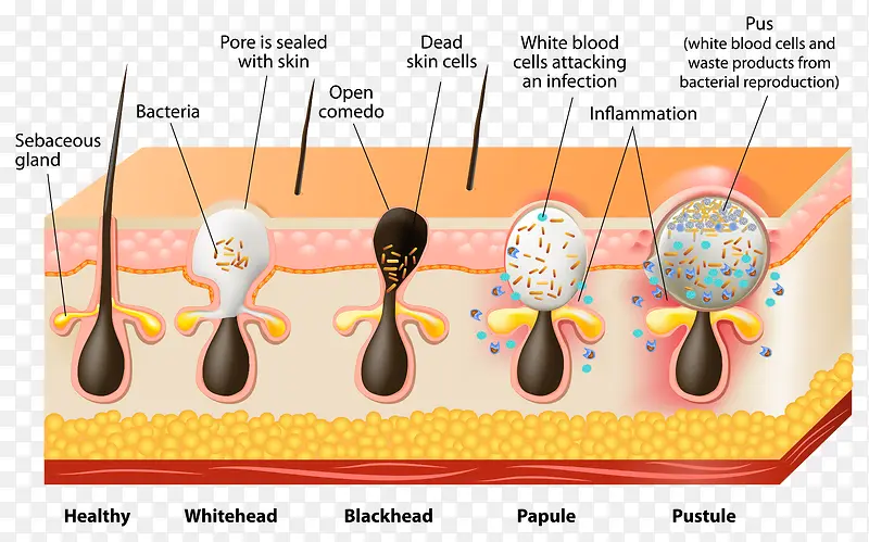 Ƥ����֯ʸ��-������