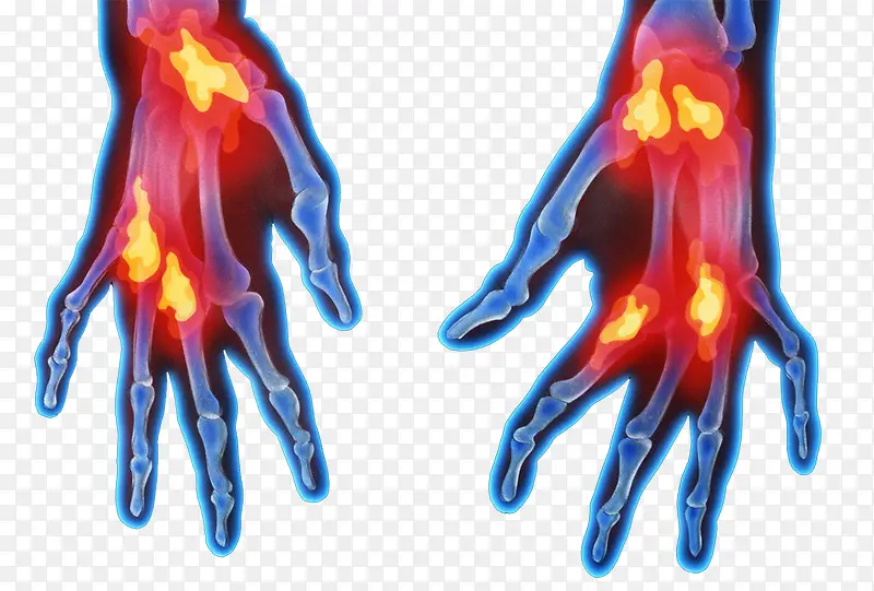 ��ָ�ؽڷ���-������