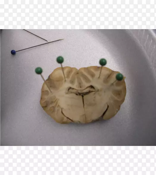 ��ɫ��-������