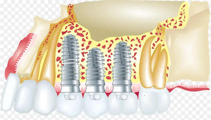 ��װ����ͼƬ-������