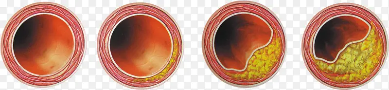 Ѫ�ܲ���-������