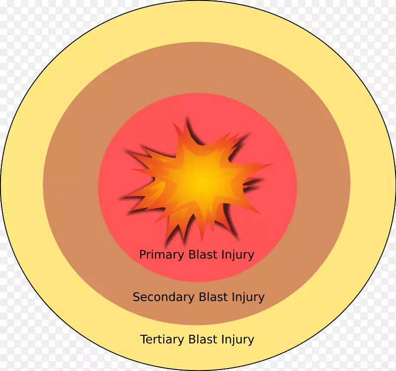 ��ը�˱�ը���ϱ�ը������-������