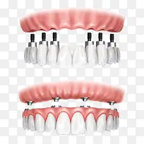 ��װ����-������