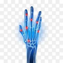 手关节-空若网 手关节-空若网