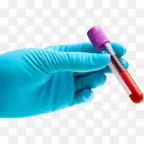 血液试验单纯疱疹病毒唇疱疹白斑支原体-空若网 血液试验单纯疱疹病毒唇疱疹白斑支原体-空若网