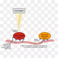 放射线治疗黑色素瘤-空若网 放射线治疗黑色素瘤-空若网
