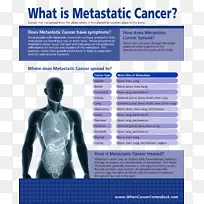 里诺赛博生活转移癌放射外科手术-脑-空若网 里诺赛博生活转移癌放射外科手术-脑-空若网