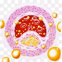 动脉硬化血管动脉心血管疾病健康血脂-空若网 动脉硬化血管动脉心血管疾病健康血脂-空若网