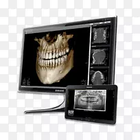 牙科计算机软件.可视化医学诊断.牙齿修复效果图-空若网 牙科计算机软件.可视化医学诊断.牙齿修复效果图-空若网