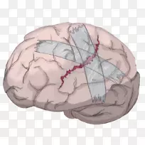 脑神经成像电视节目-空若网 脑神经成像电视节目-空若网
