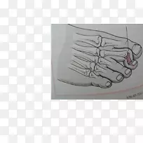 数字锤趾脚槌指手-空若网 数字锤趾脚槌指手-空若网