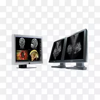 lcd电视电脑显示器液晶显示器barco coronis 5mp ips面板多显示器-空若网 lcd电视电脑显示器液晶显示器barco coronis 5mp ips面板多显示器-空若网