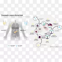 胰腺癌免疫治疗癌症研究所-空若网 胰腺癌免疫治疗癌症研究所-空若网