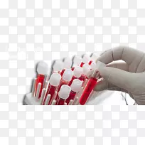 血液试验血型献血病理-适当的营养-空若网 血液试验血型献血病理-适当的营养-空若网