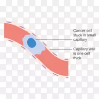 癌症血管血细胞-血液-空若网 癌症血管血细胞-血液-空若网