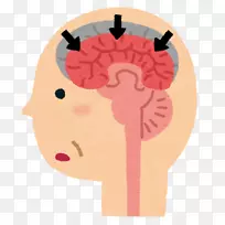 血管性痴呆、阿尔茨海默病、有路易体的老年痴呆症-阿尔茨海默病-空若网 血管性痴呆、阿尔茨海默病、有路易体的老年痴呆症-阿尔茨海默病-空若网