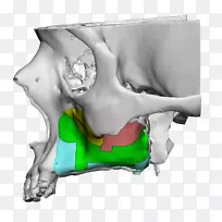 ���������-������