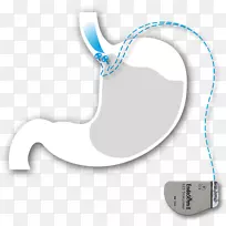 体饰字体-胃食管反流病-空若网 体饰字体-胃食管反流病-空若网