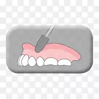 齿舌设计-空若网 齿舌设计-空若网