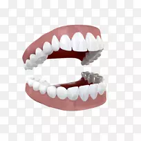 人体牙体摄影.开牙-空若网 人体牙体摄影.开牙-空若网