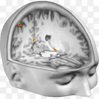 体外经验脑神经科学神经成像-脑-空若网 体外经验脑神经科学神经成像-脑-空若网