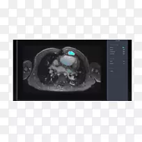 Amazon.com亚马逊网络服务业务癌症计算机断层扫描-磁共振成像软件-空若网 Amazon.com亚马逊网络服务业务癌症计算机断层扫描-磁共振成像软件-空若网