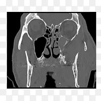 l ketieteellinen r ntgenkuvaus��X����Ӱ-����-������