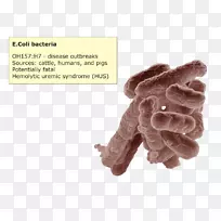 5号舱。平拇指手套大肠埃希菌-空若网 5号舱。平拇指手套大肠埃希菌-空若网