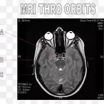 脑断层摄影术-脑-空若网 脑断层摄影术-脑-空若网