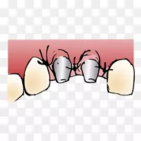 卡通手指字体-种植牙-空若网 卡通手指字体-种植牙-空若网