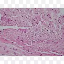 神经组织周围神经系统-神经-空若网 神经组织周围神经系统-神经-空若网