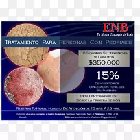 材料性银屑病-空若网 材料性银屑病-空若网