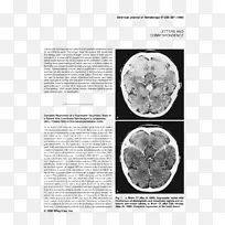 脑组织白色字体-空若网 脑组织白色字体-空若网
