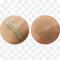 蛋痤疮皮肤-空若网 蛋痤疮皮肤-空若网