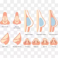 鼻子面欧式-不同的鼻子-空若网 鼻子面欧式-不同的鼻子-空若网