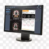 多媒体计算机监视器附件设计-空若网 多媒体计算机监视器附件设计-空若网