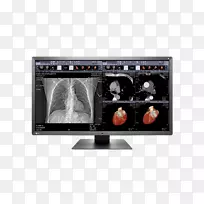 电脑显示器Eizo辐射力mx 242w 4k分辨率百万像素-空若网 电脑显示器Eizo辐射力mx 242w 4k分辨率百万像素-空若网