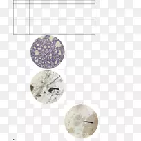 �Ͷ�˹&����Ȧ��ťȦ-������