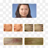 鼻颊,下巴-鼻子-空若网 鼻颊,下巴-鼻子-空若网