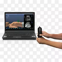 上网本声纳计算机硬件个人电脑膝上型电脑-空若网 上网本声纳计算机硬件个人电脑膝上型电脑-空若网