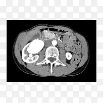 CT医学X线摄影骨字体肾静脉-空若网 CT医学X线摄影骨字体肾静脉-空若网