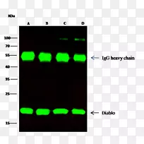 单克隆抗体免疫球蛋白轻链免疫球蛋白重链抗体人抗鼠抗体-空若网 单克隆抗体免疫球蛋白轻链免疫球蛋白重链抗体人抗鼠抗体-空若网