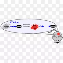 自体紫杉醇溶血磷脂酸肿瘤医学成像荧光放大癌细胞动画-空若网 自体紫杉醇溶血磷脂酸肿瘤医学成像荧光放大癌细胞动画-空若网
