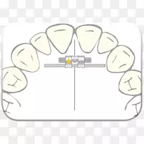 Scheu-nadimco g��������ָ-Flecha infadora-������