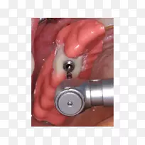 �꾮�����꾮��Ƶ��ָ��������-������