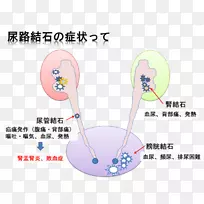 肾结石排泄系统泌尿外科癌症肾脏病-空若网 肾结石排泄系统泌尿外科癌症肾脏病-空若网